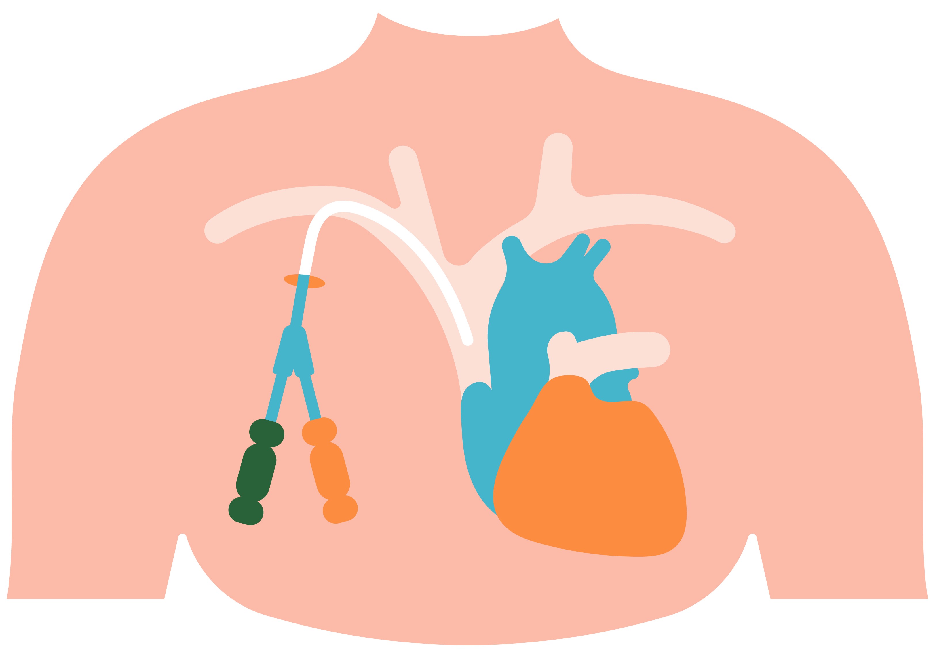 Vascular Acess-Catheter.jpg